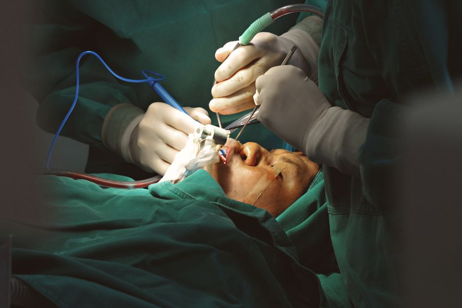 How to track Plastic and Cosmetic Surgery leads from click to booked job in Singapore