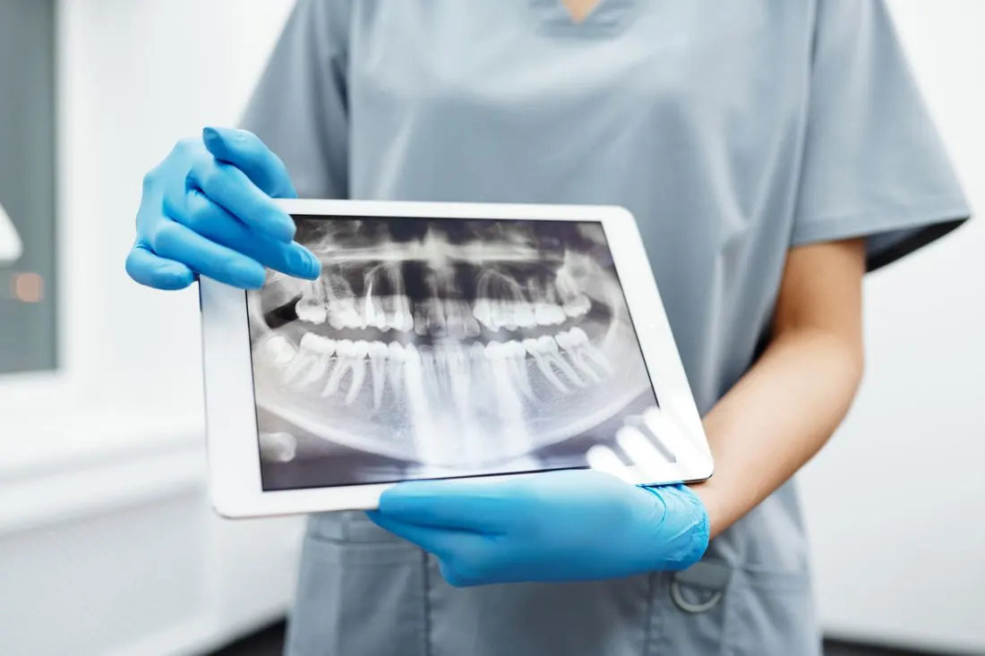 Blue-gloved hands in grey scrubs holding a white tablet that shows a panoramic dental X-ray, with the clinician's face out of frame. Photo by Cedric Fauntleroy on Pexels